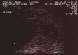 Sonogram 12/11/03.