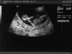 Sonogram 1/8/04.