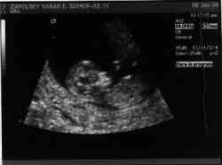 Sonogram 1/8/04.